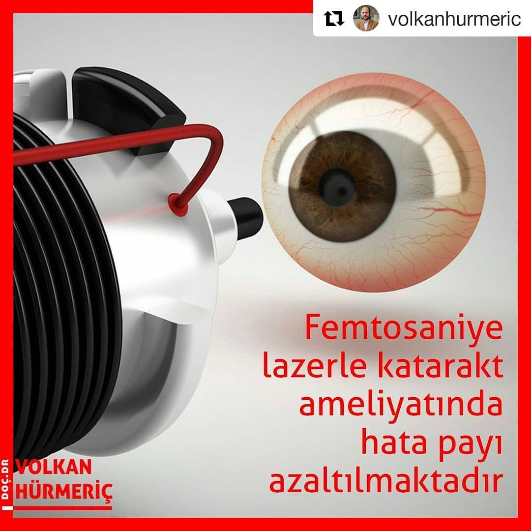 #Repost @volkanhurmeric (@get_repost)
・・・
Bilgisayar teknolojisinden faydalanarak uyguladığımız femtosaniye lazerle katarakt ameliyatlarının süresini kısaltmanın yanı sıra komplikasyon oranını aza indirebiliyoruz. Hastalarımızın görüşü de yine bu teknolojiyle daha hızlı bir şekilde düzelebiliyor. #DrVolkanHurmeric #dünyagöz #dünyagözankara #gözdoktoru #katarakt #lazertedavisi #lasik #femtosaniyelazer #keratokonus #toriklens #keratoplasti #kornea #korneanakli